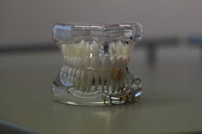 appareil dentaire amovible